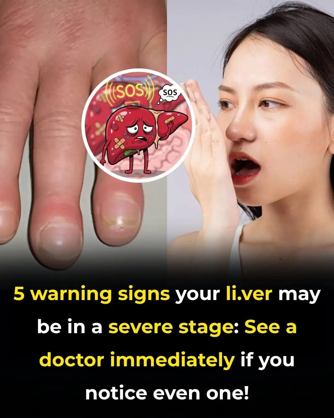 Bruising Easily? Itchy Skin? 5 Hidden Signs of Liver Damage You Might Be Overlooking