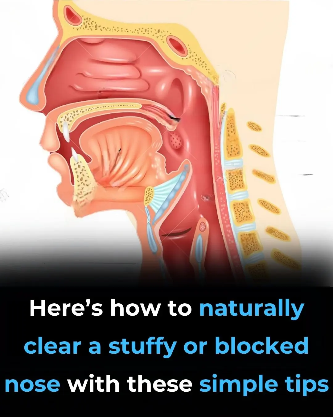 Home Remedies for Blocked and Stuffy Nose