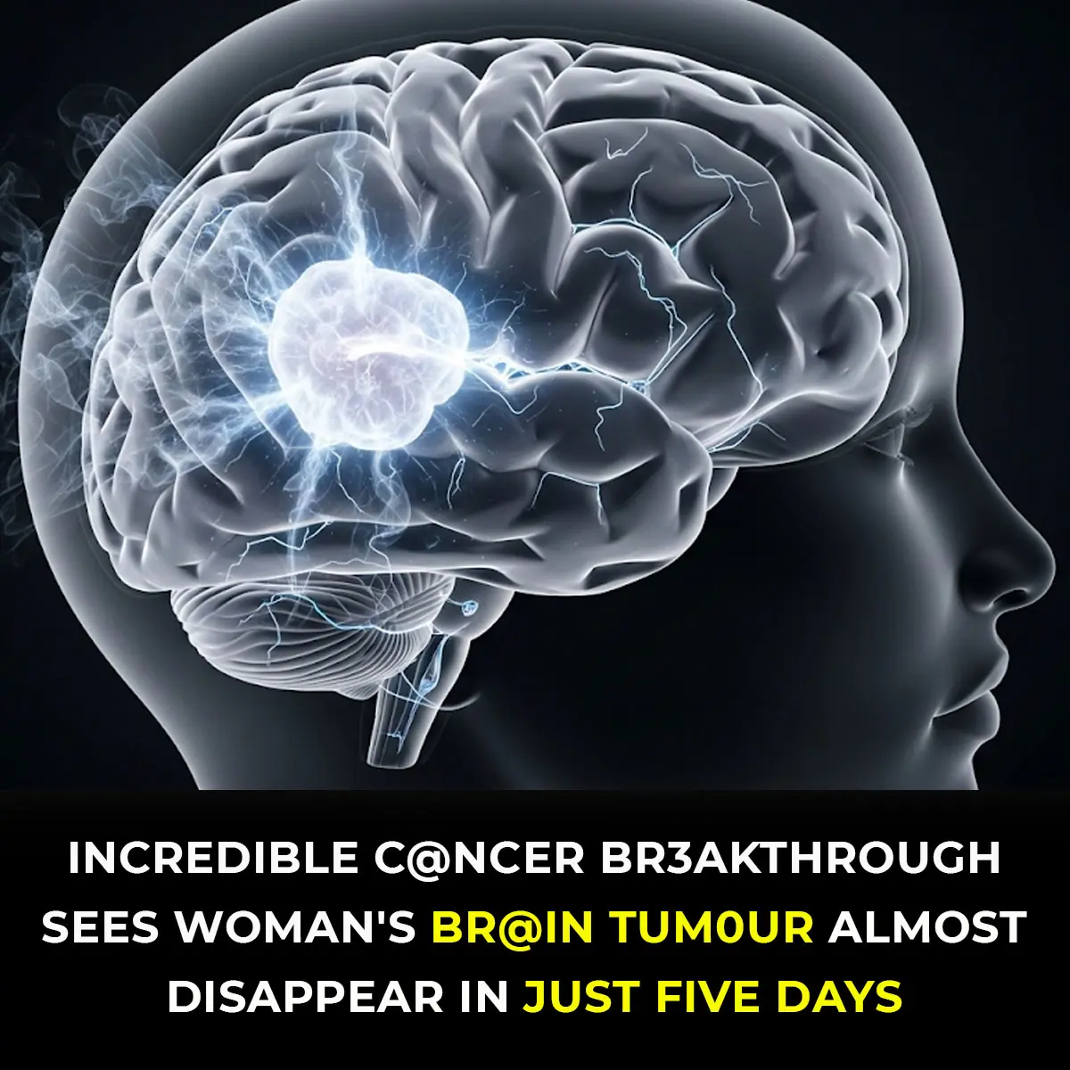 Woman’s Inoperable Brain Tumor Shrinks In Just Five Days Thanks To Cancer Breakthrough