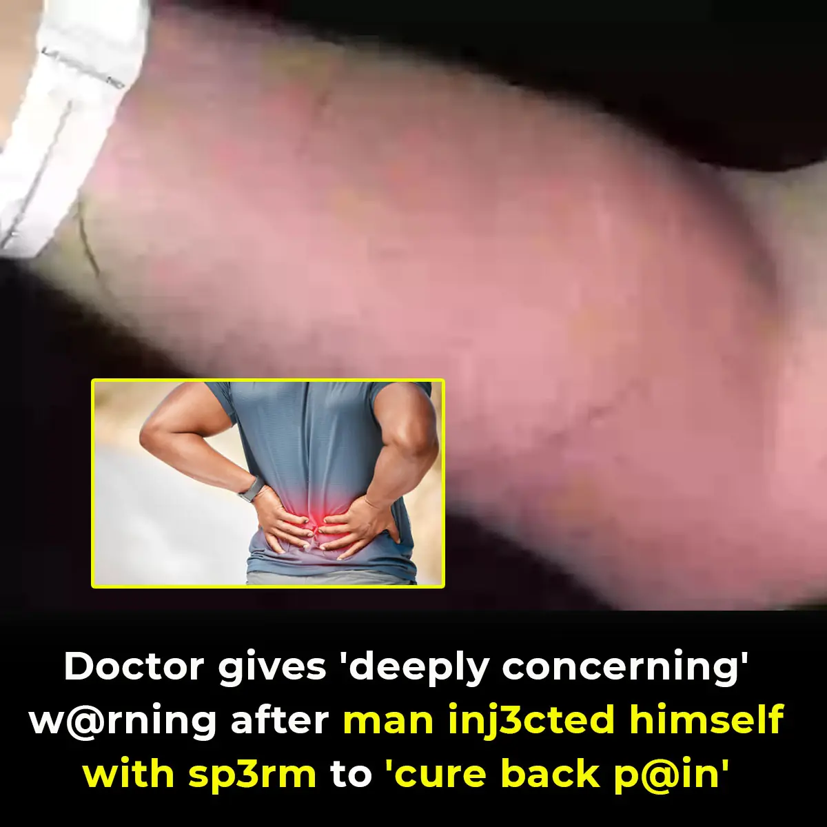 Doctor gives 'deeply concerning' warning after man injected himself with sperm to 'cure back pain'