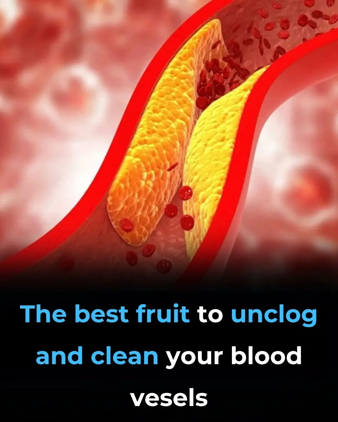 The best fruits to unclog and clean your blood vessels