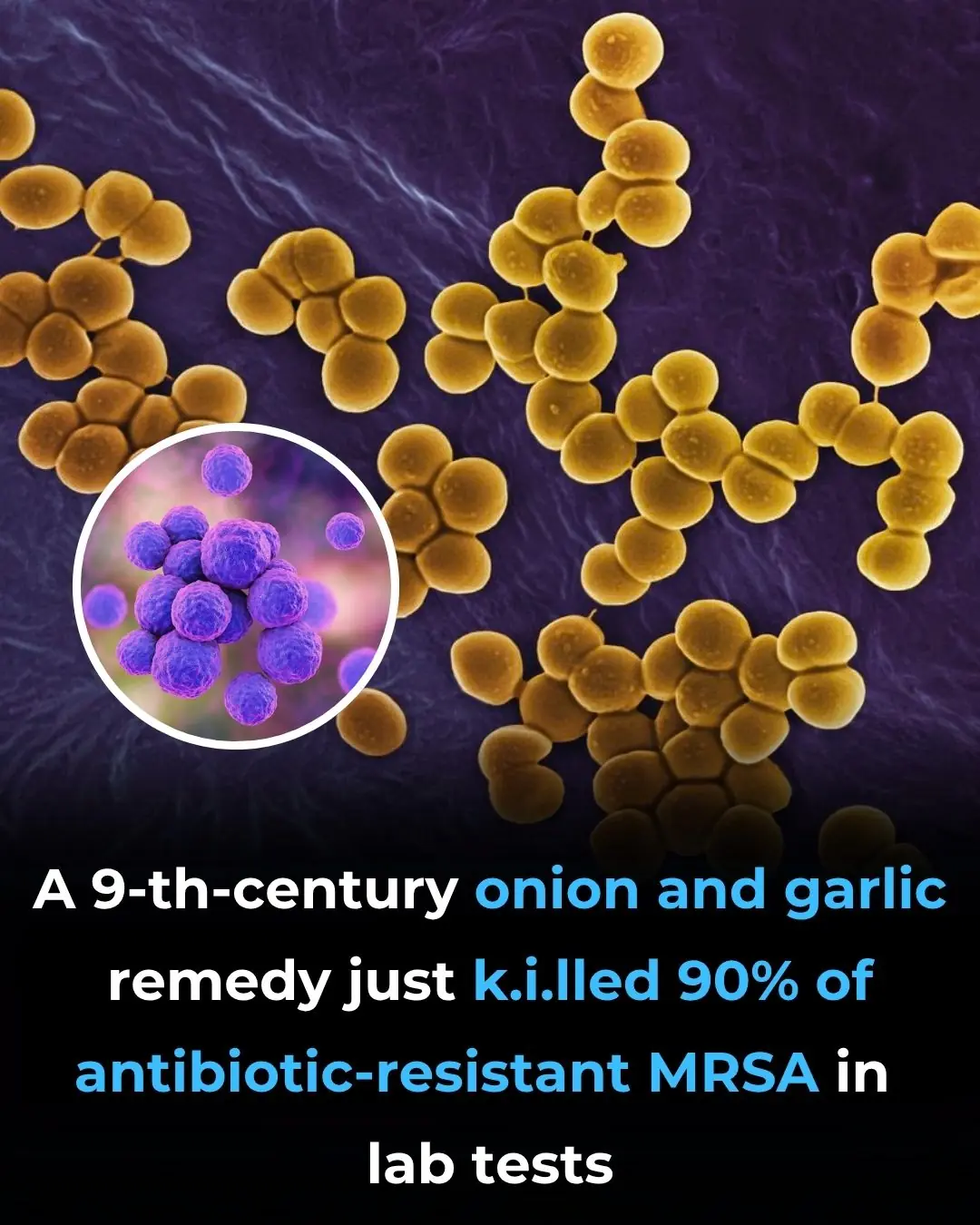 1,000-year-old onion and garlic eye remedy kills MRSA