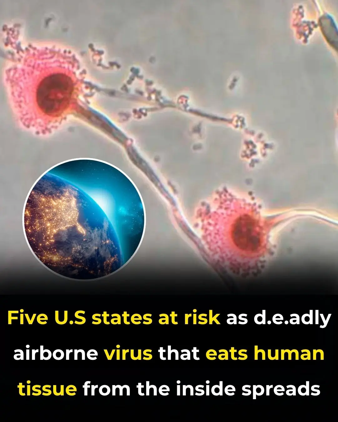 Five US States Brace for Deadly Airborne Fungus That Destroys Human Tissue