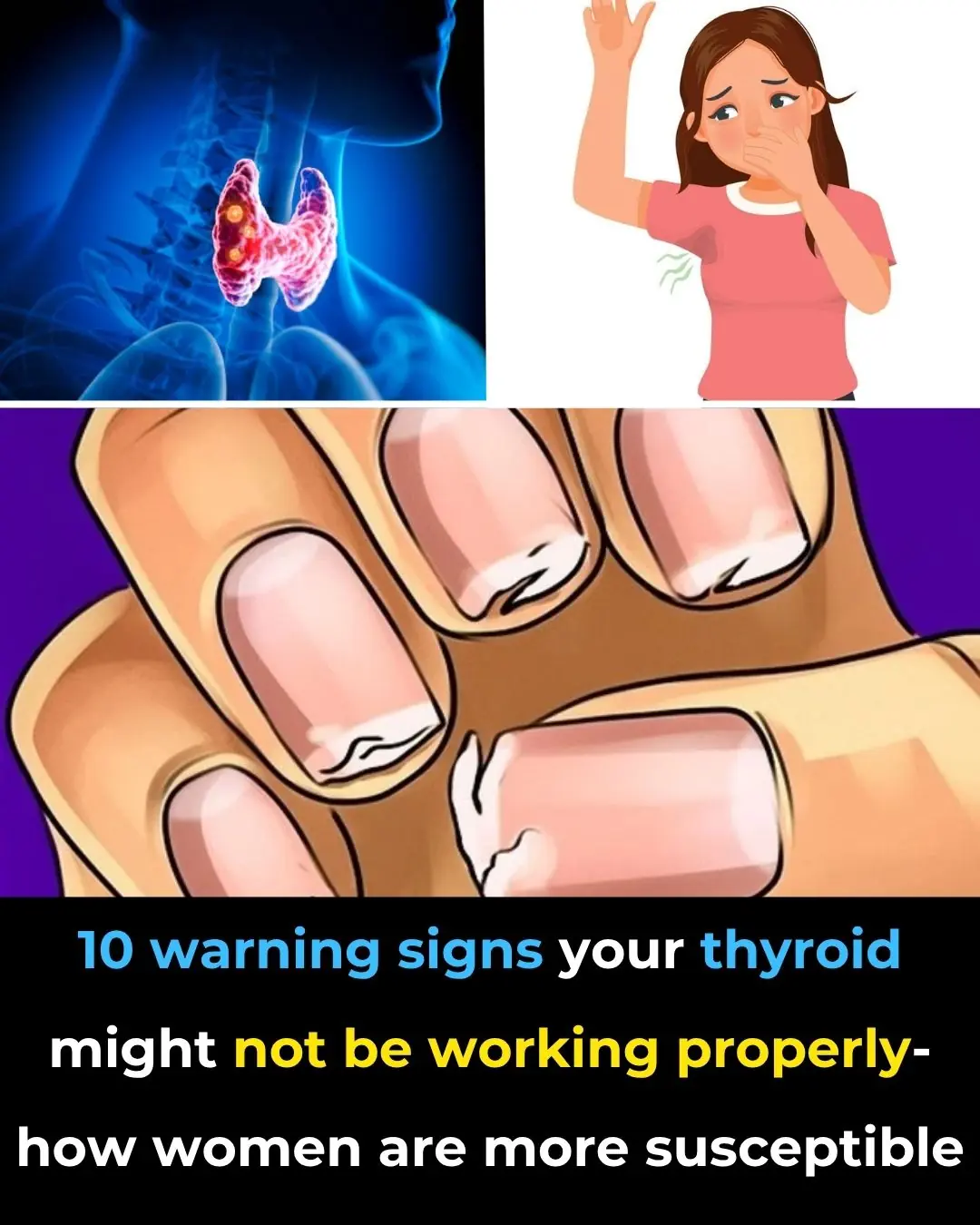 Thyroid Gland: How to Balance Its Hormones
