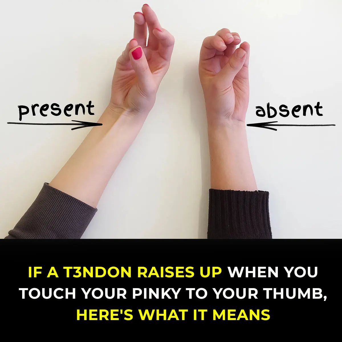 A A tendon raises up when you touch your pinky to your thumbraises up when you touch your pinky to your thumb