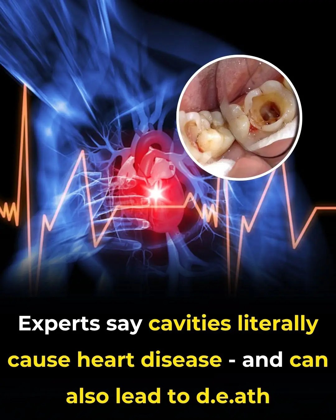 Experts Say Cavities Literally Cause Heart Disease And Can Also Lead to Death