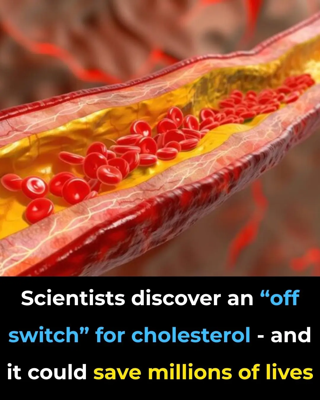 Scientists Discover An “Off Switch” For Cholesterol—And It Could Save Millions Of Lives