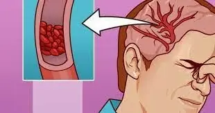 9 Warning Signs of Magnesium Deficiency You Shouldn't Ignore