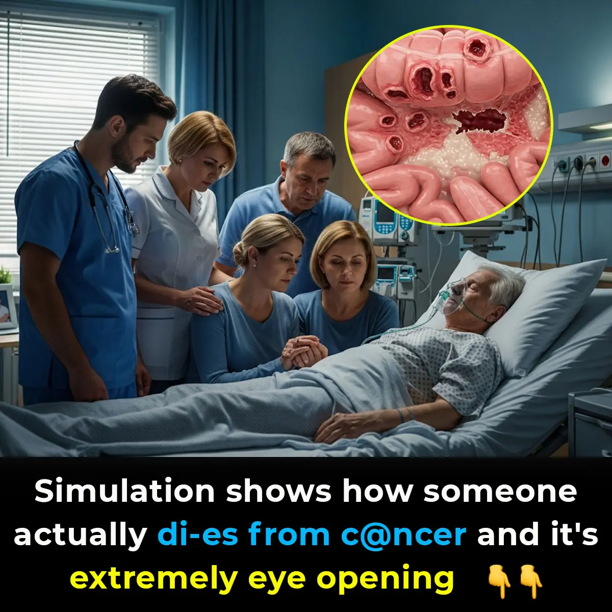 Striking simulation illustrates the progression of death from cancer