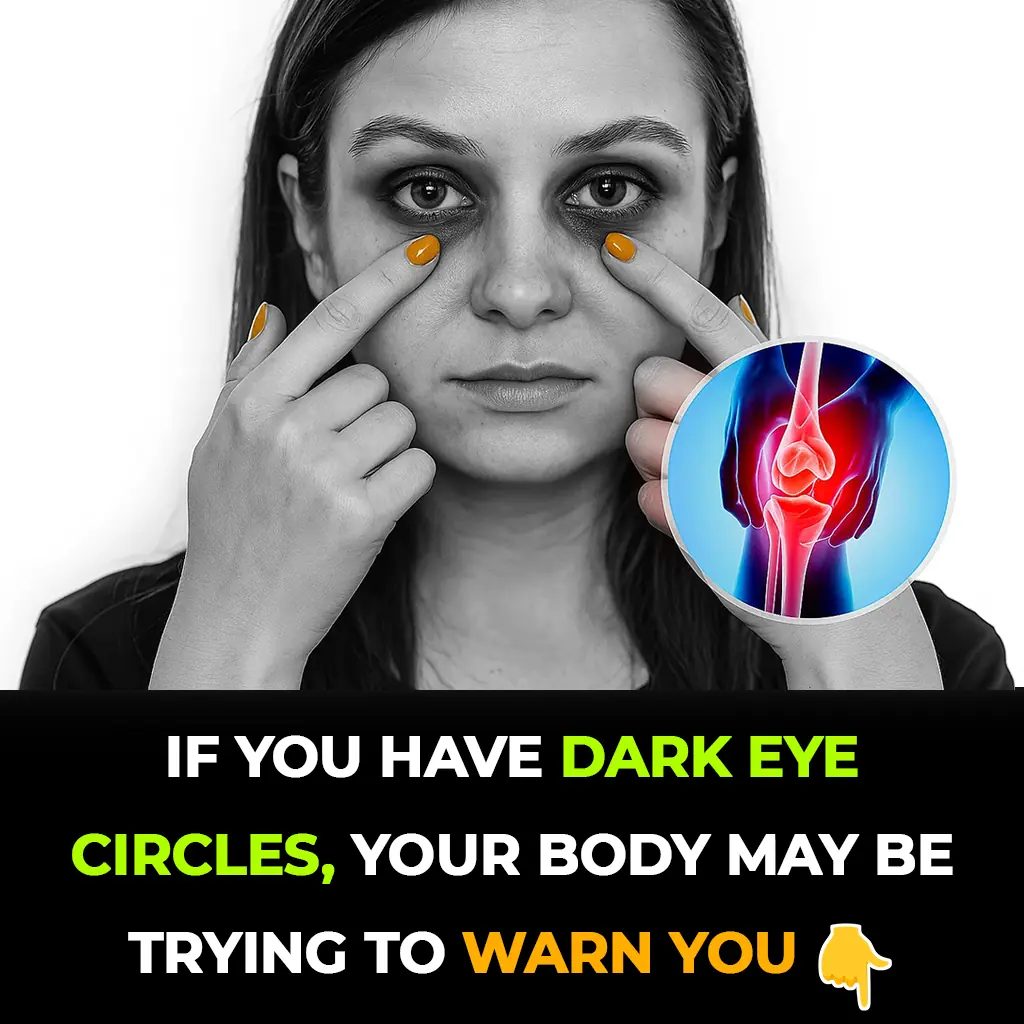 Dark eye circles might be a subtle health warning