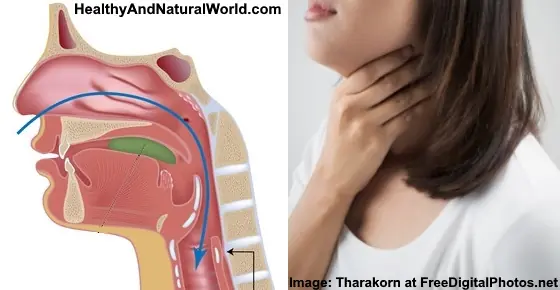 Get Rid of Throat Mucus Faster With These Home Treatments (Evidence Based)