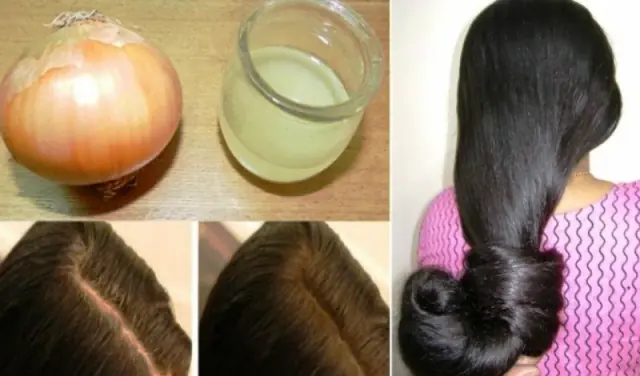 How to Make Onion Juice for Hair Growth & Strong Hair
