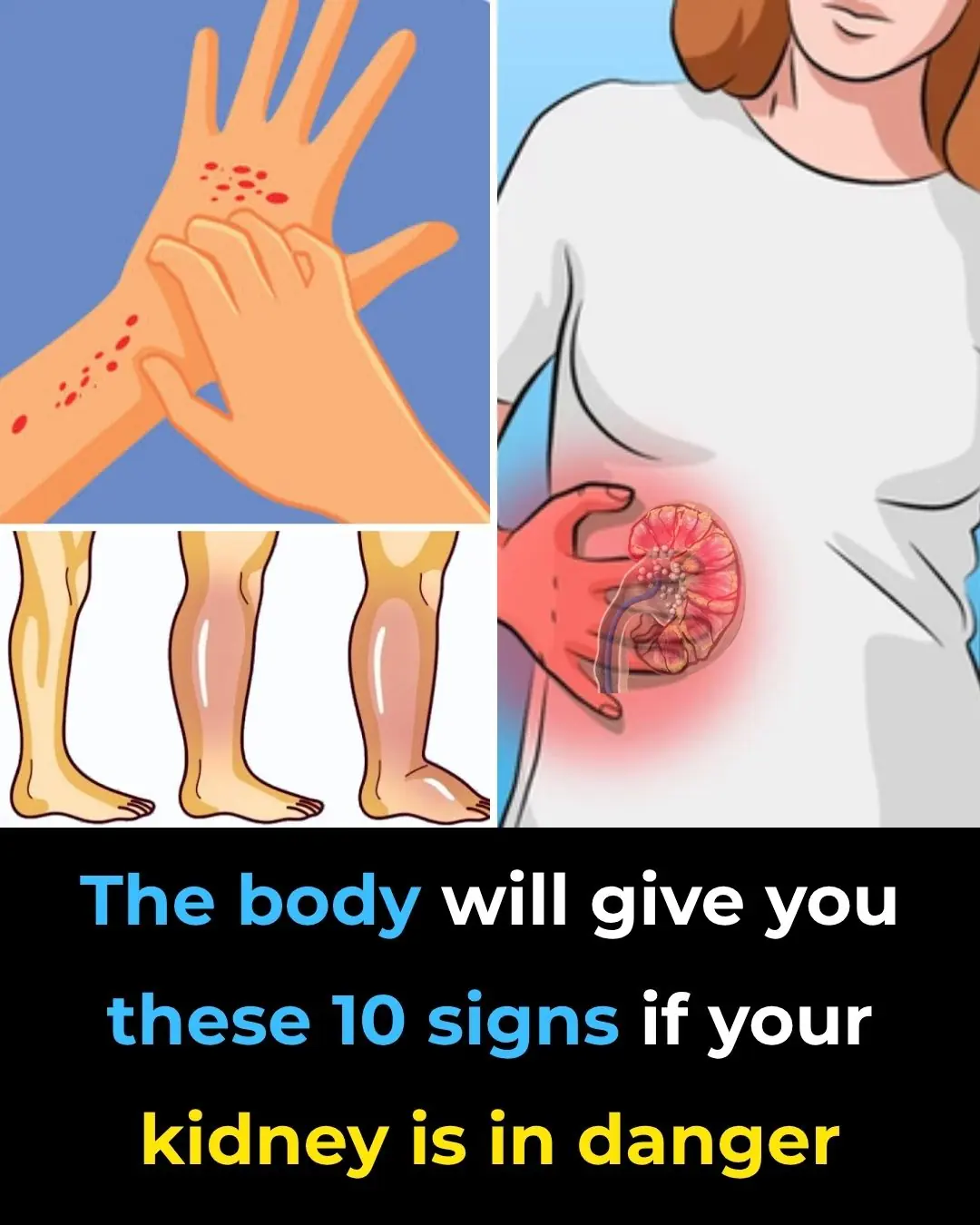 10 Symptoms of Kidney Disease