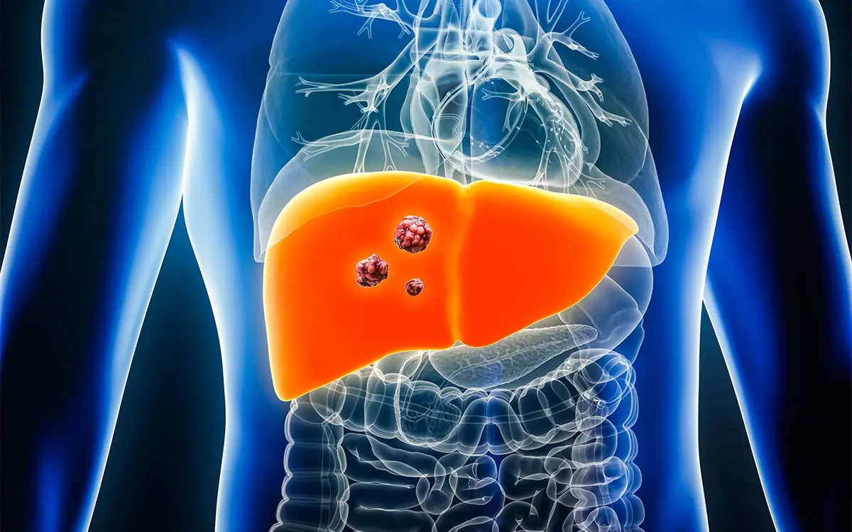 5 Common Habits Silently Destroying Your Liver (Most People Do Them!)