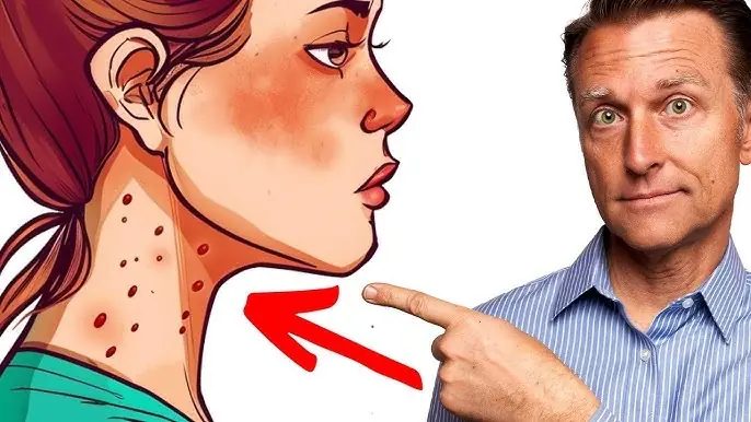 12 Urgent Warning Signs You’re Eating Too Much Sugar