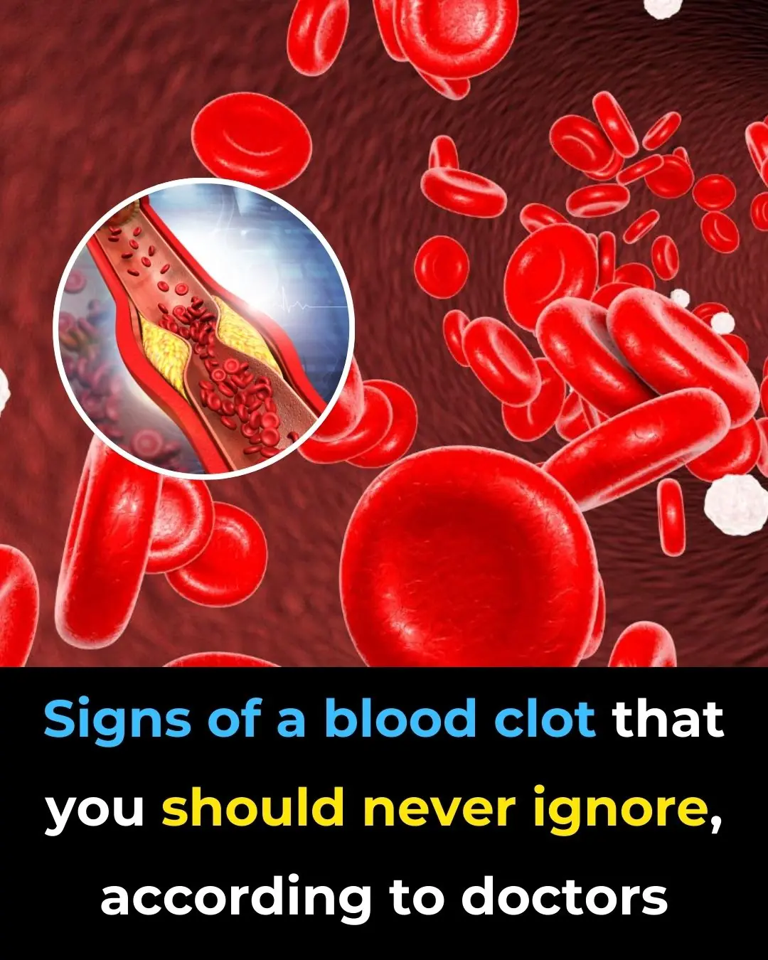 Signs of a Blood Clot That You Should Never Ignore, According to Doctors