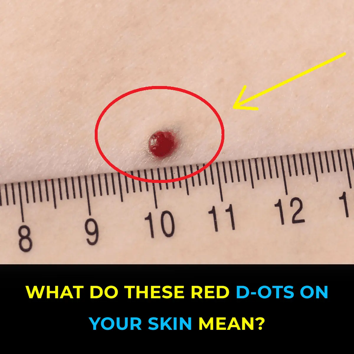 11 Reasons Why You Have Red Dots On Your Skin