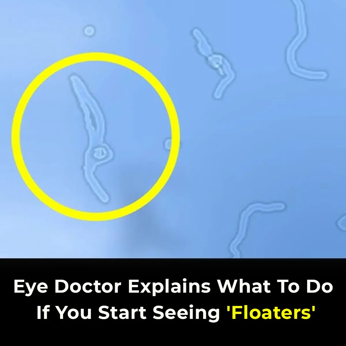 What Are Eye Floaters? Here What To Do If you Start Seeing Them, According to an Eye Doctor