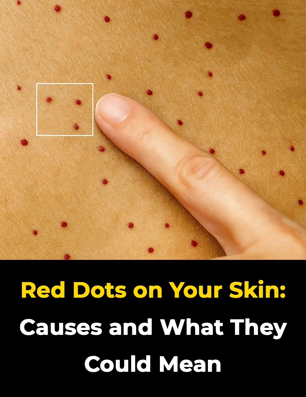 11 Sh0cking Causes of Red Dots on Your Skin and How to Treat Them