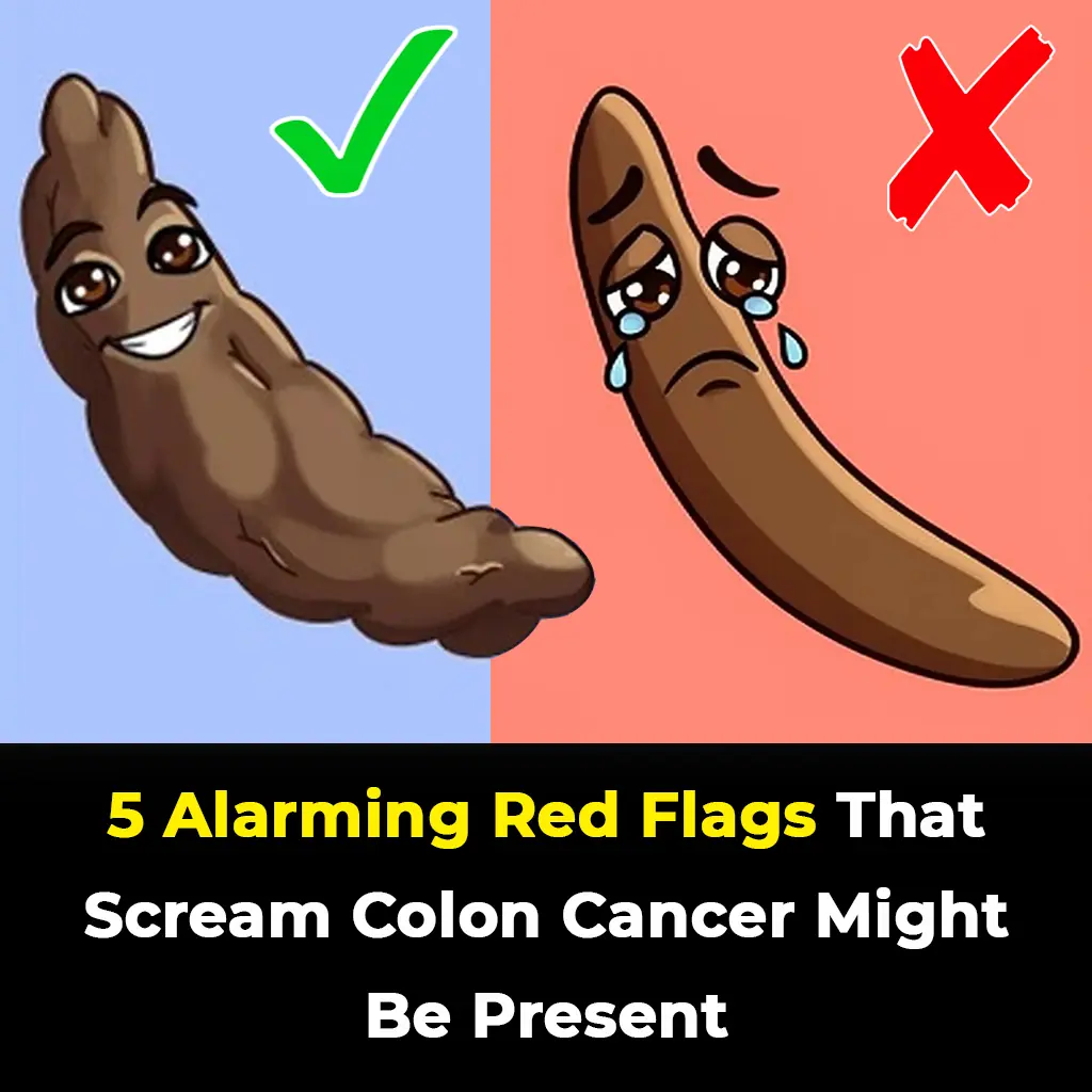 5 Warning Signs That Could Indicate Colon Cancer