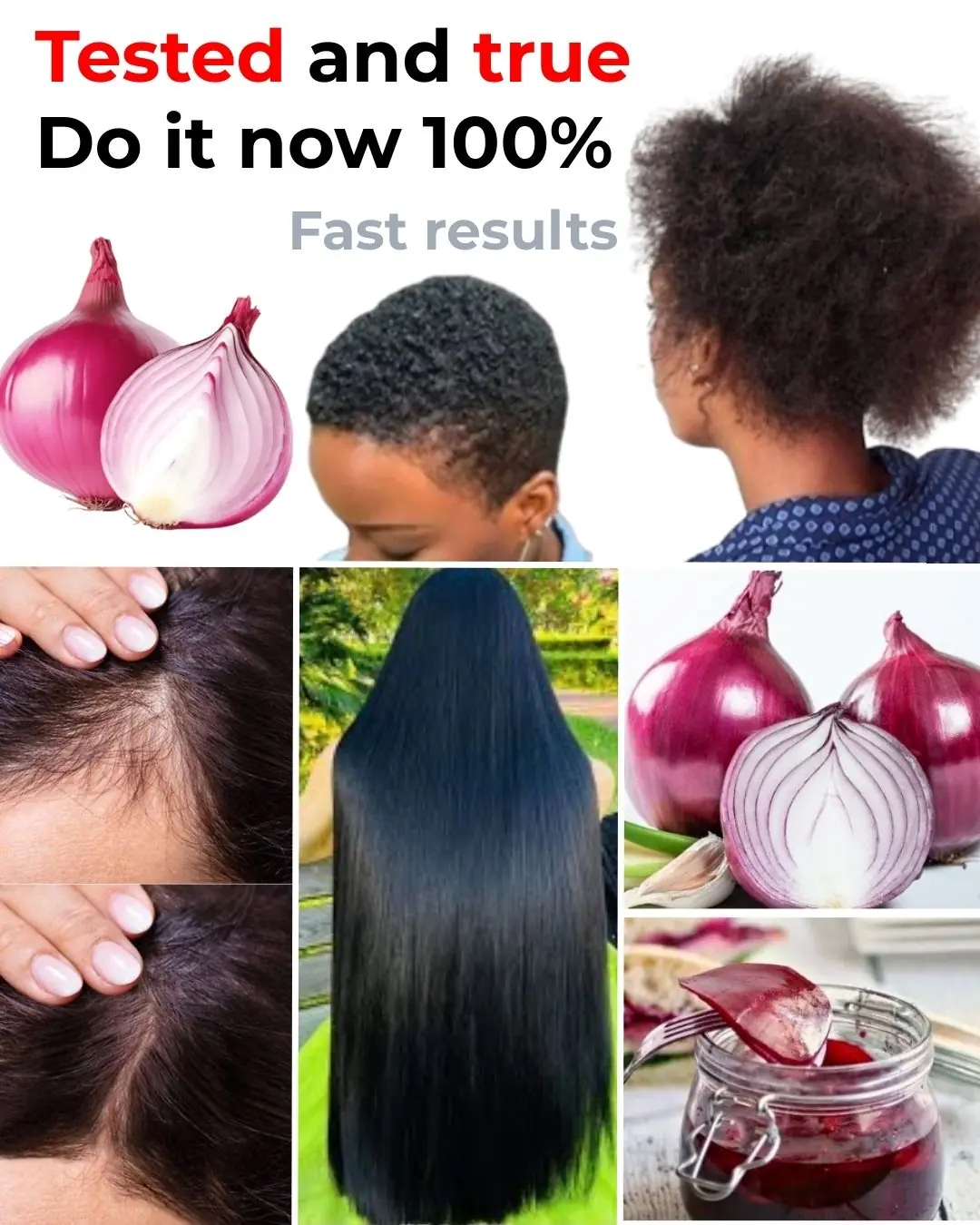 How to Naturally Dye Your Gray Hair with Onion Peels—No Surprises, Just Beautiful Results