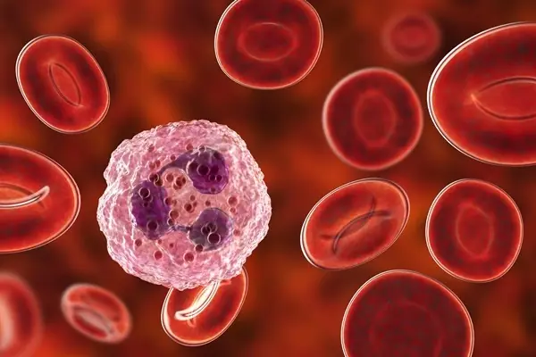 Not Many People Know the Early Warning Signs That Cancer Is Growing in Your Body