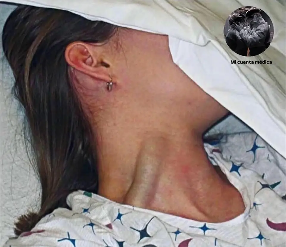 Massive jugular vein distension: a warning sign you shouldn’t ignore