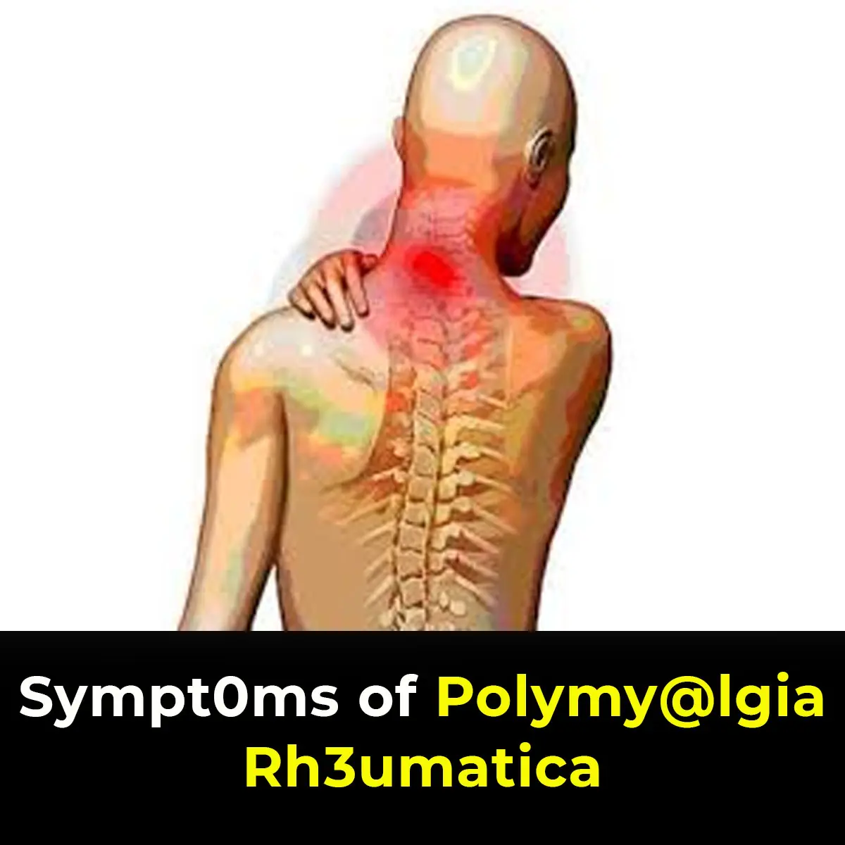 Important Signs To Look For That Could Suggest You Have Polymyalgia Rheumatica