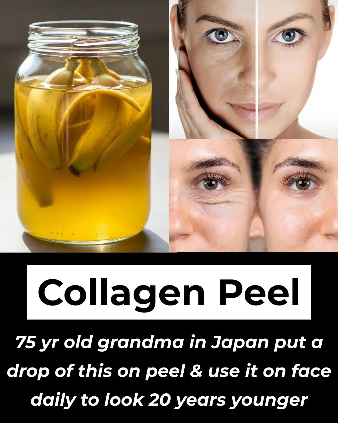 Rub Banana Peel on Face for Clear Skin – Remove Pimples & Dark Spots