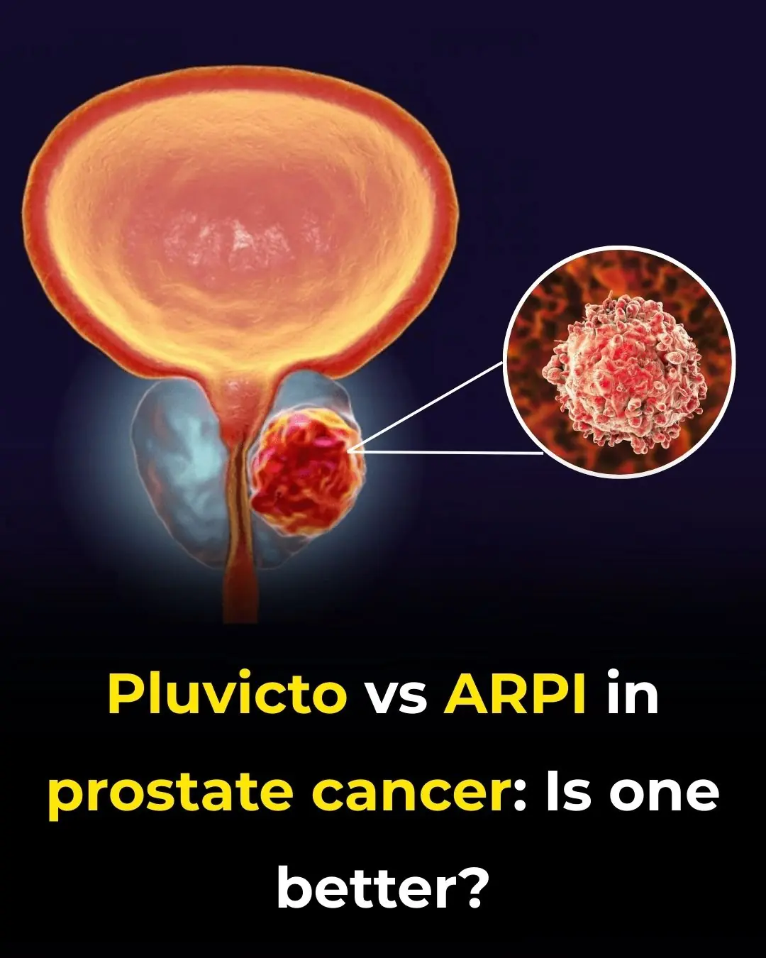 Pluvicto vs ARPI in Prostate Cancer: Is One Better?
