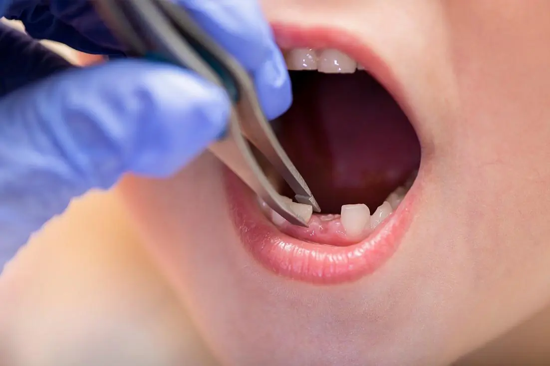 A Pill to Regrow Your Teeth? The Future of Dentistry is Here
