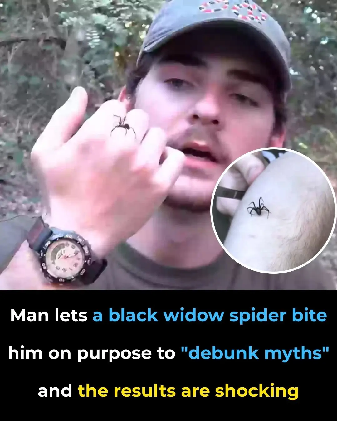 Brave Man Allows Black Widow to Bite Him