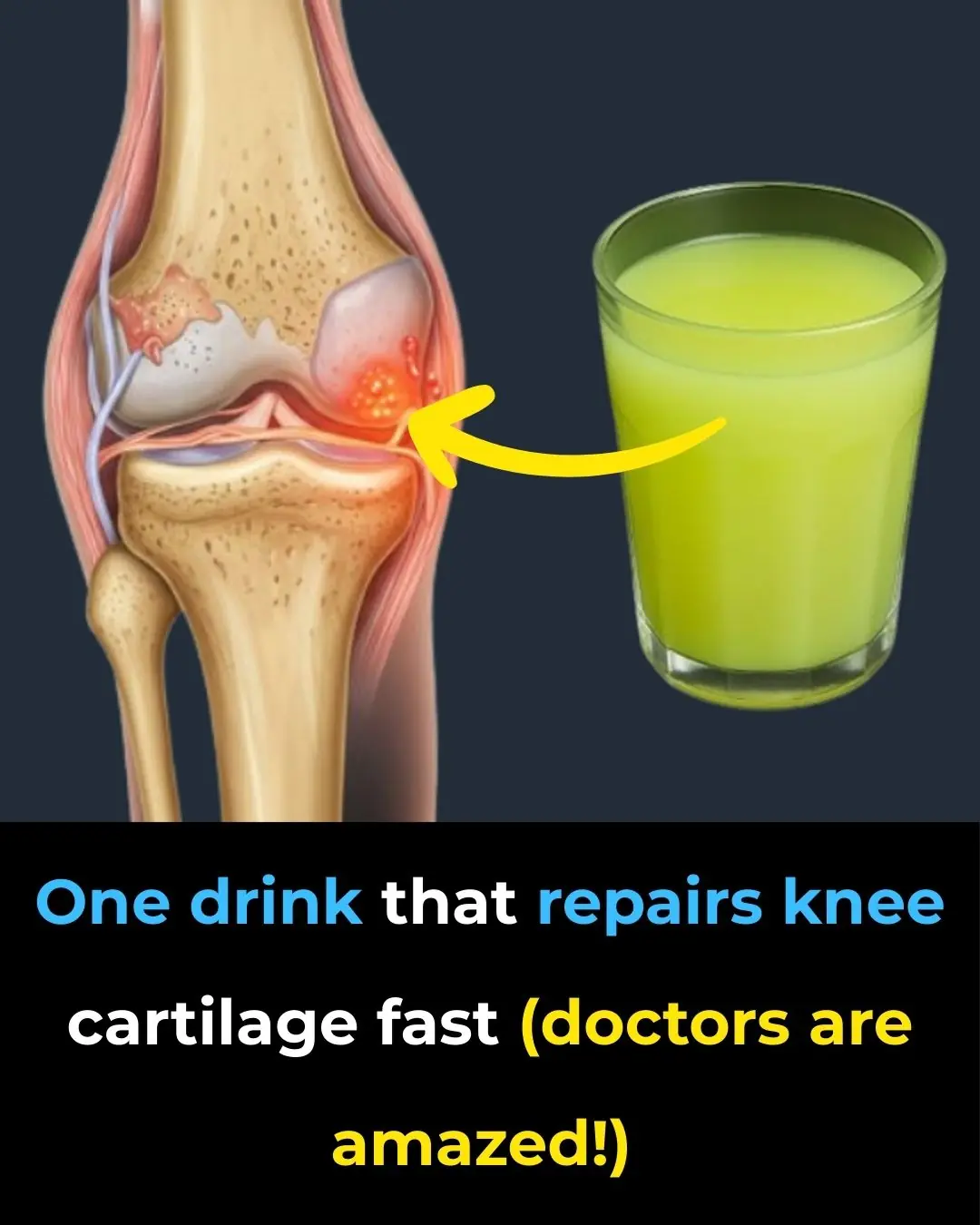One drink that repairs knee cartilage fast (doctors are amazed!)