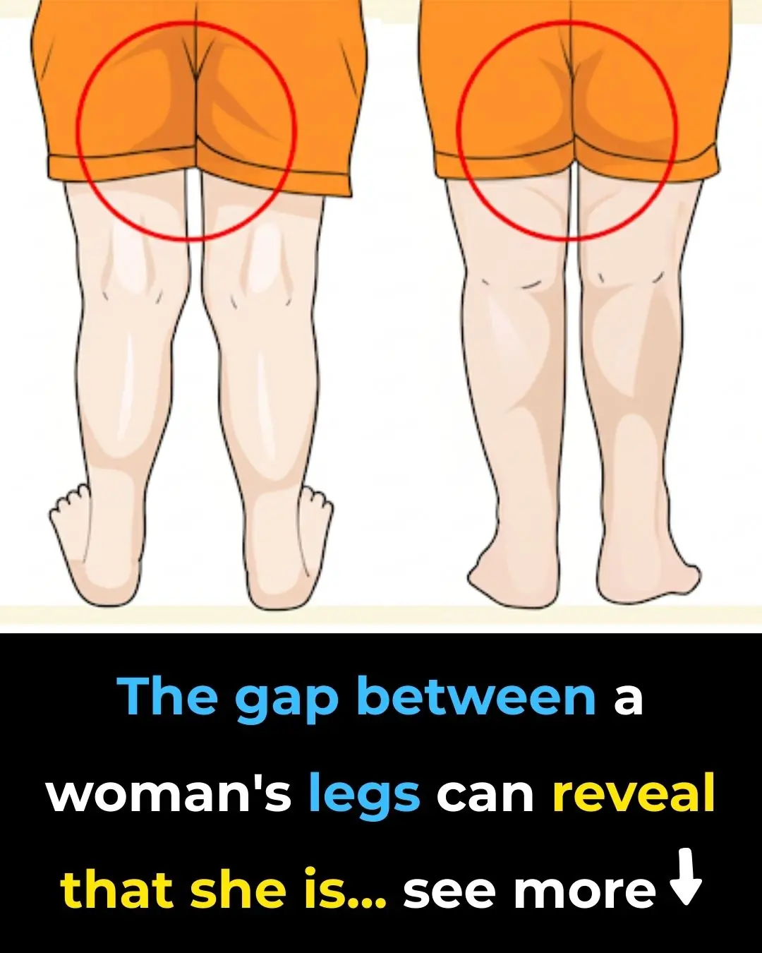 The gap between a woman’s legs can reveal that she is…
