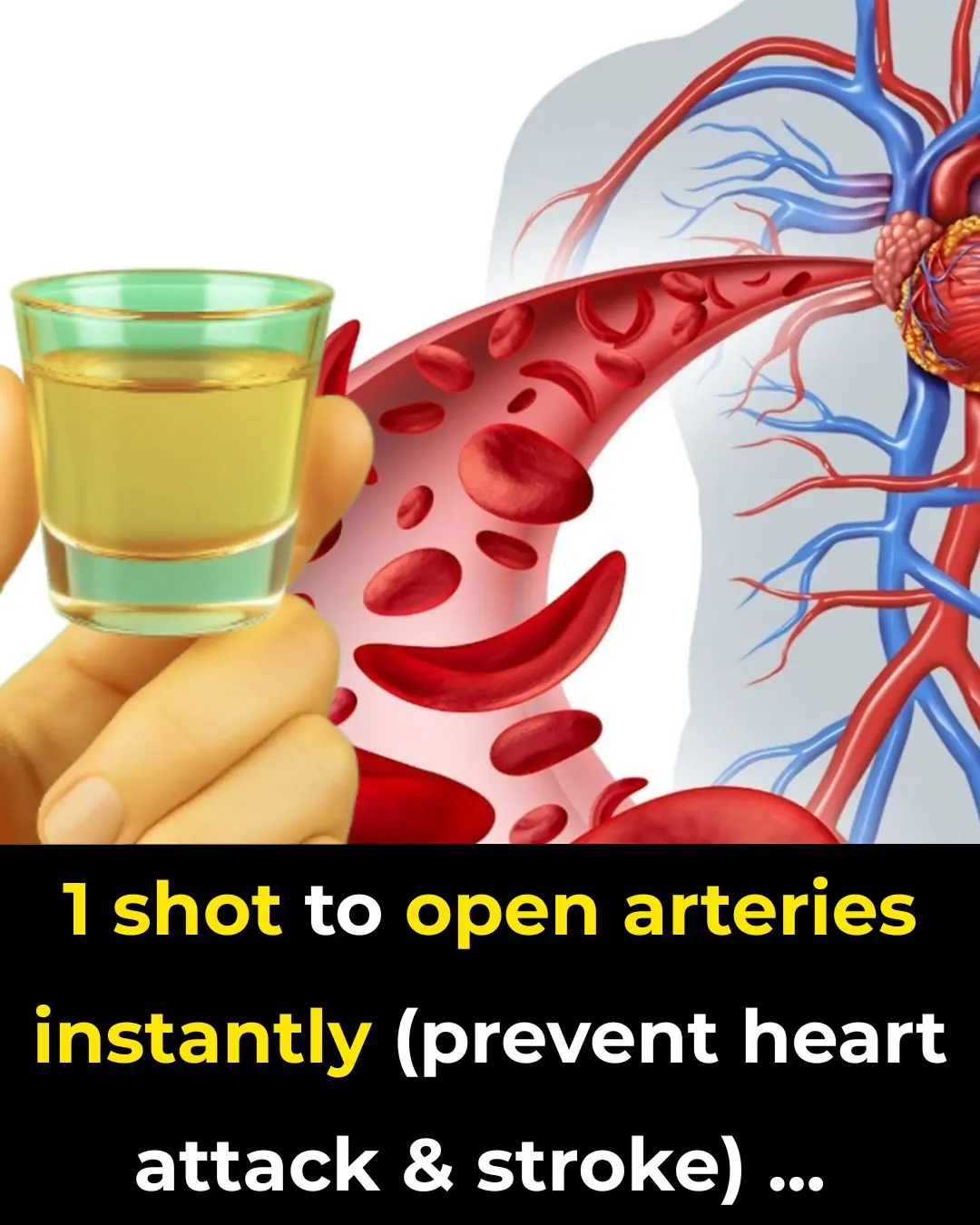 1 shot to open arteries instantly (prevent heart attack & stroke)