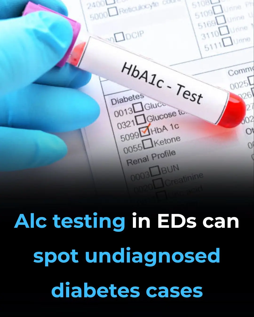 A1c Testing in EDs Can Spot Undiagnosed Diabetes Cases