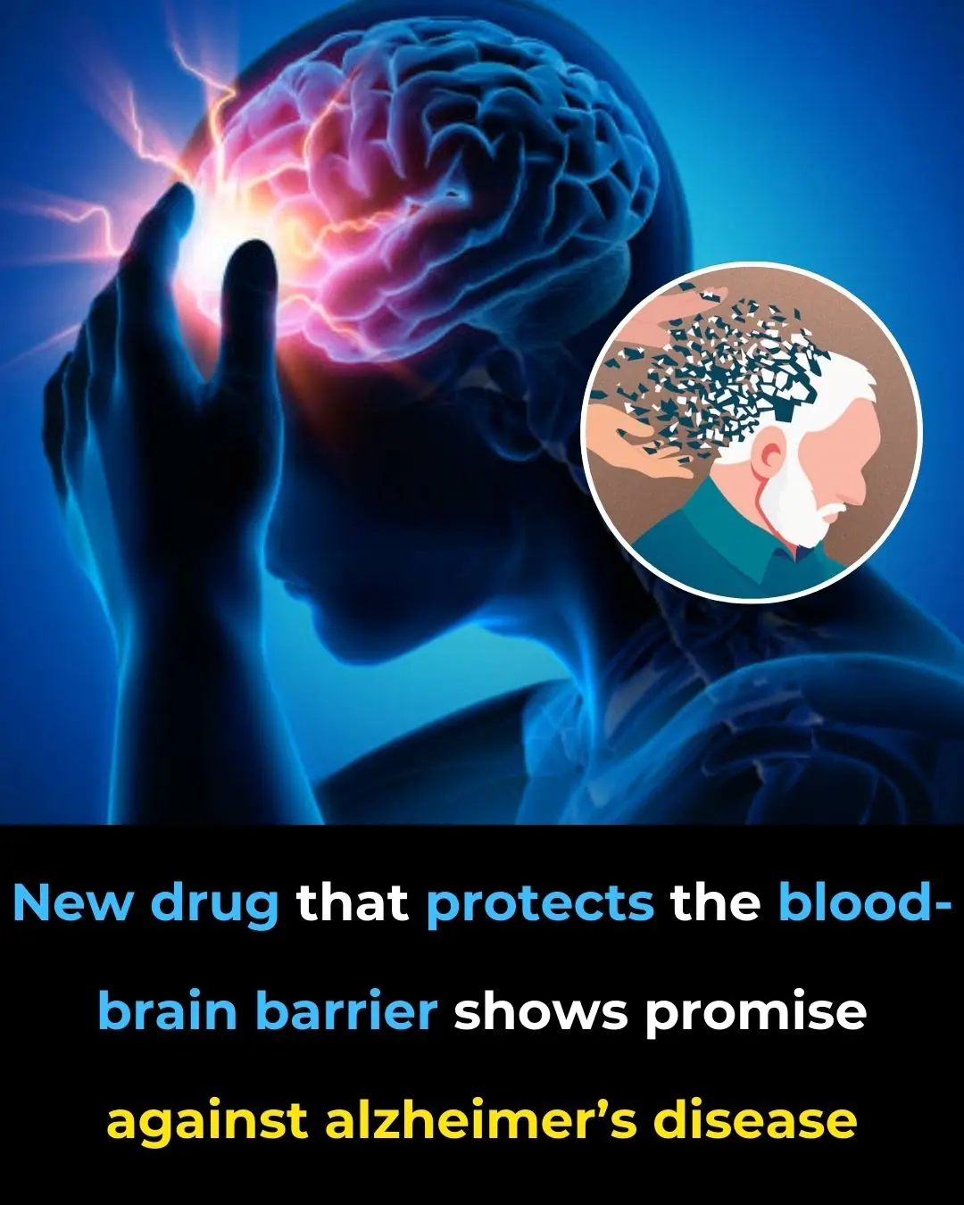 New Drug That Protects the Blood-Brain Barrier Shows Promise Against Alzheimer’s Disease