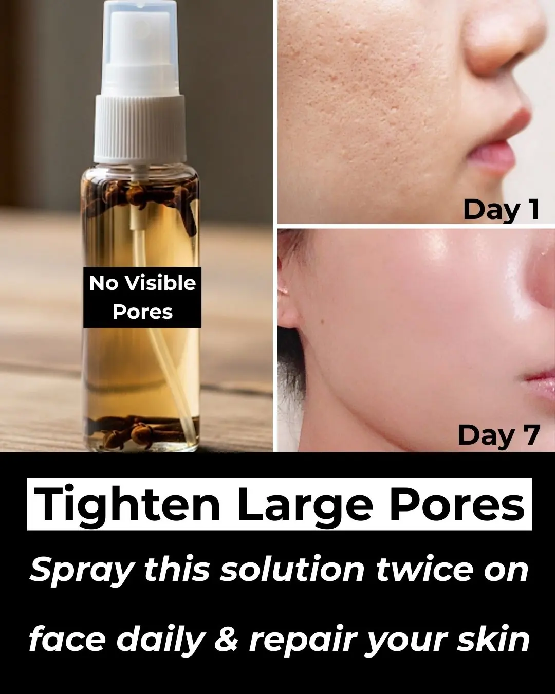 Clove benefits for Skin – Clove Oil, Clove Gel & Clove ice cubes