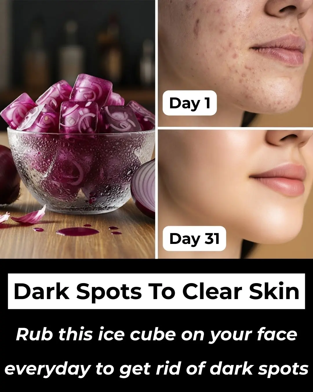 Onion Ice Cubes: Clear Dark Spots and Achieve Radiant Skin