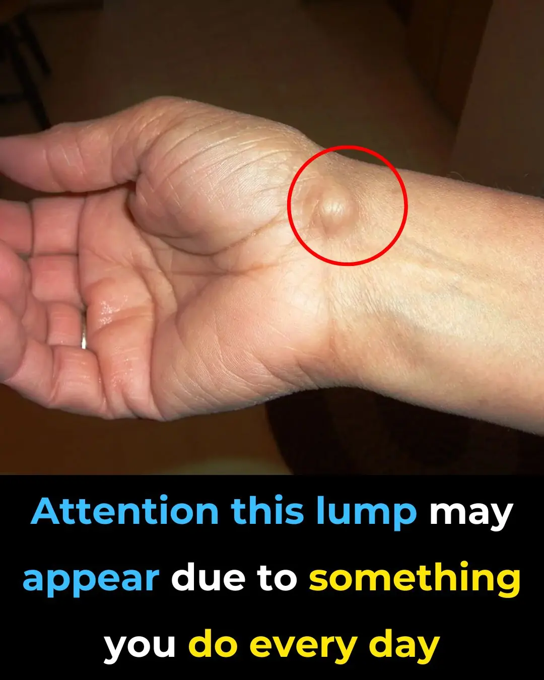 Everyday Habits That Can Cause a This Issue To Your Hands