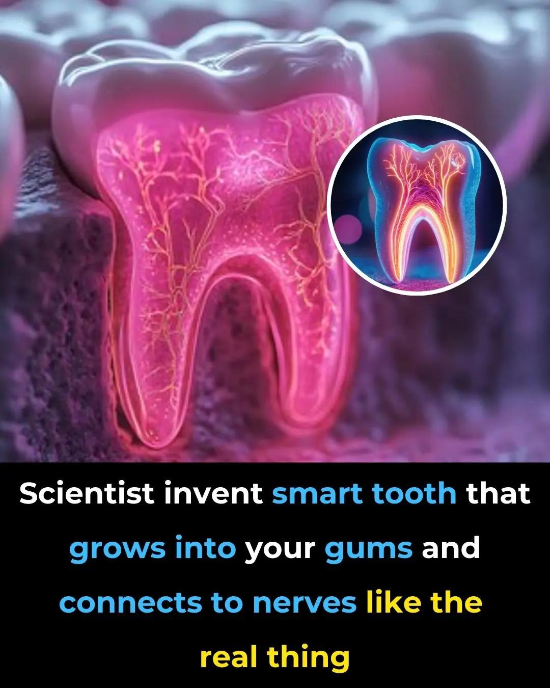 Scientists Invent Smart Tooth That Grows Into Your Gums And Connects To Nerves Like the Real Thing