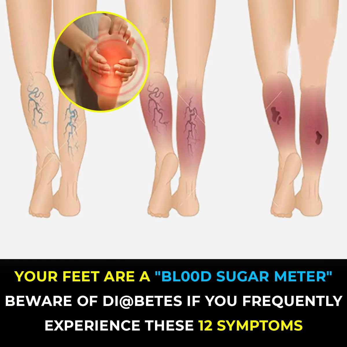 10 Symptoms of Diabetes That May Show Up In Your Feet