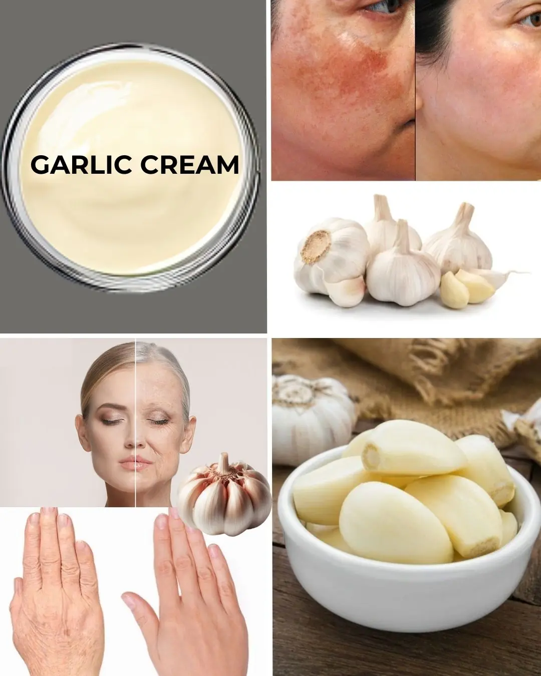 🌿 Natural Collagen Boost: Garlic Remedy for Smoother Skin