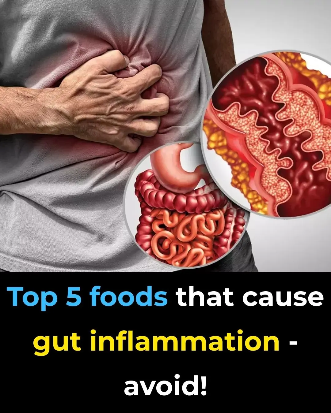 Top 5 Foods that cause Gut Inflammation – Avoid!