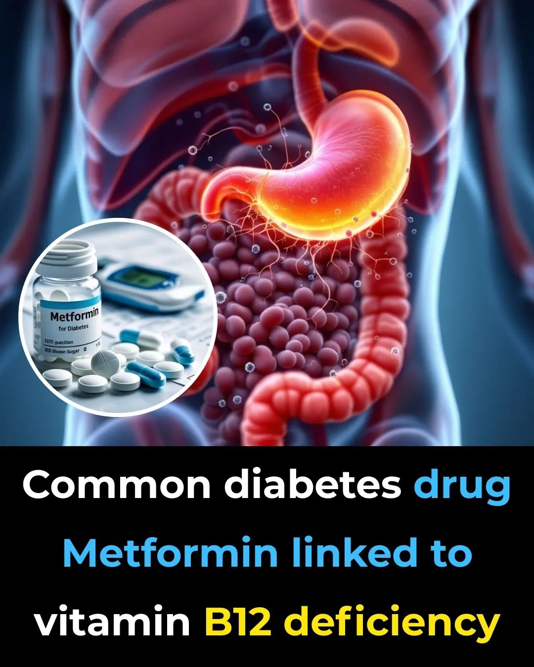 Common Diabetes Drug Metformin Linked to Vitamin B12 Deficiency