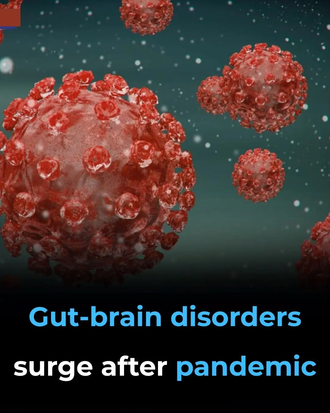 Gut-Brain Disorders Surge After Pandemic