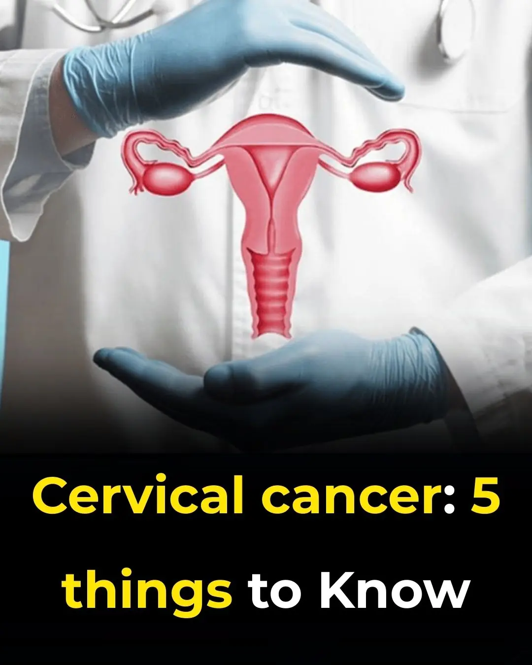 Cervical Cancer: 5 Things to Know