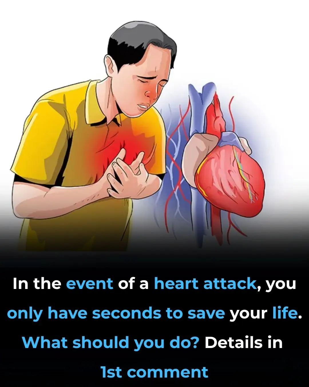Heart Attack How to React in the Moment