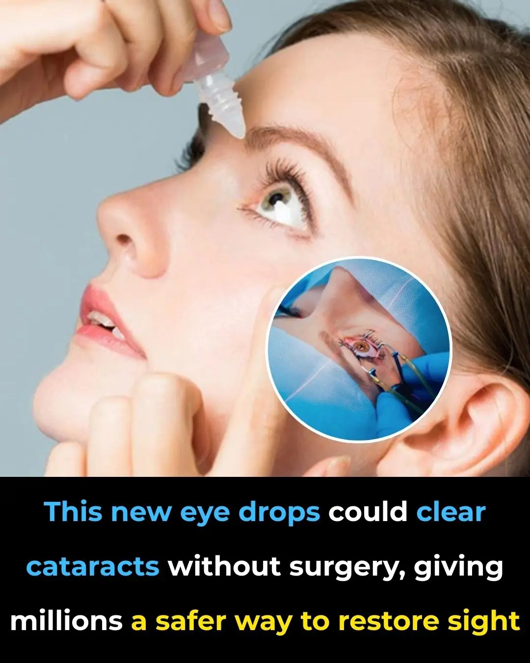 This New Eye Drops Could Clear Cataracts Without Surgery, Giving Millions a Safer Way to Restore Sight