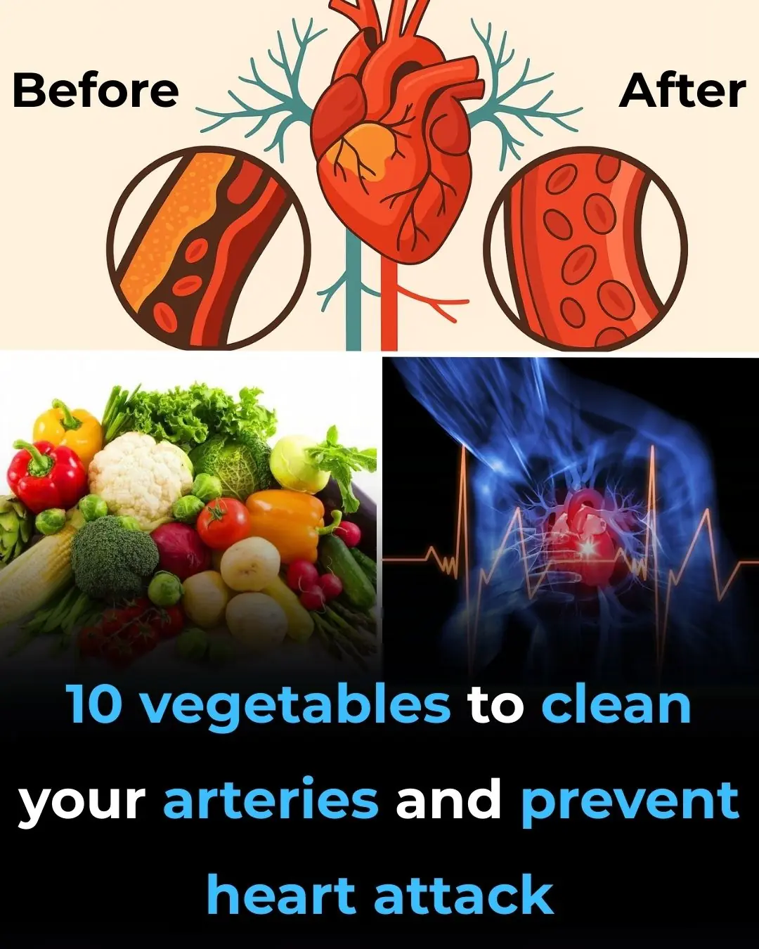 Vegetables To Clean Your Arteries And Prevent Heart Attack